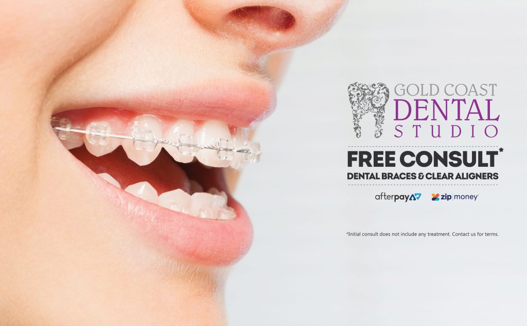 dental_braces_aug_2020 Orthodontics at Gold Coast Dental Studio